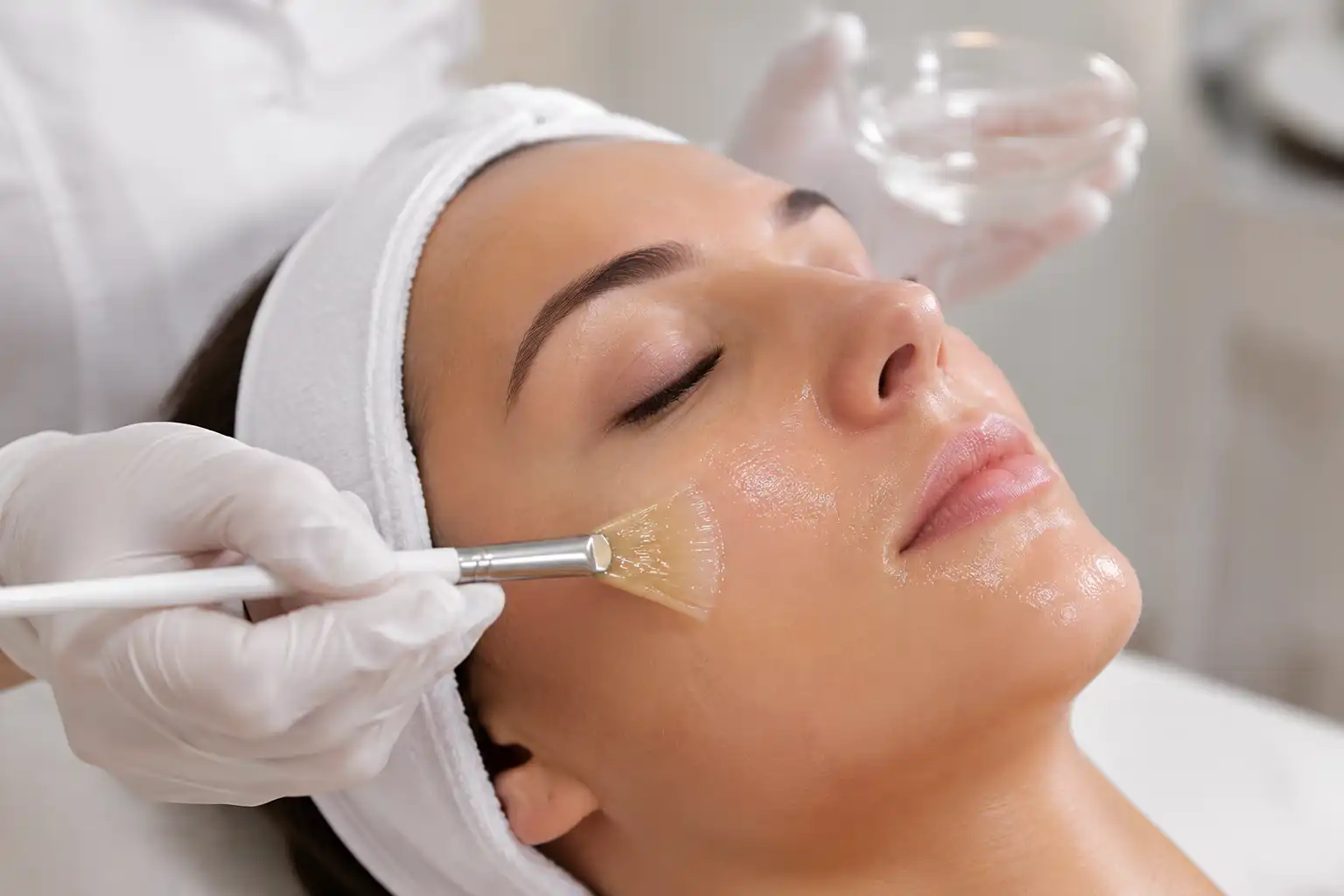 Chemical Peels